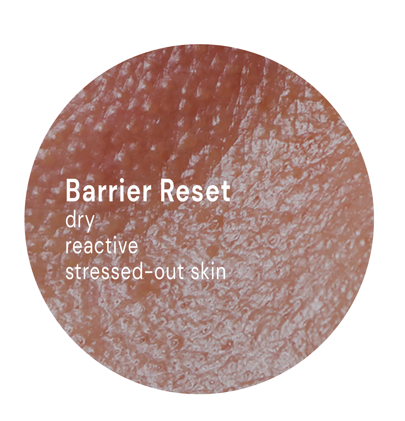 Barrier Reset System