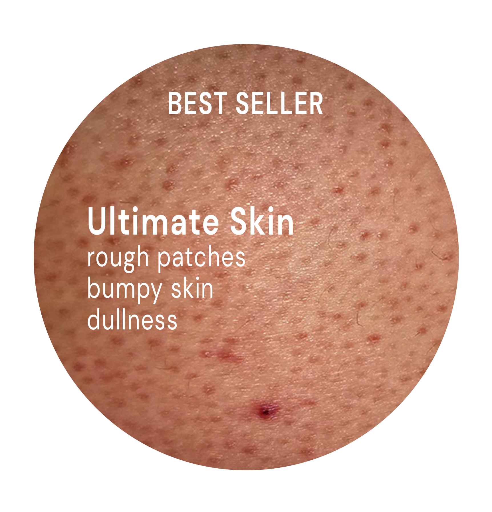 Ultimate Skin System