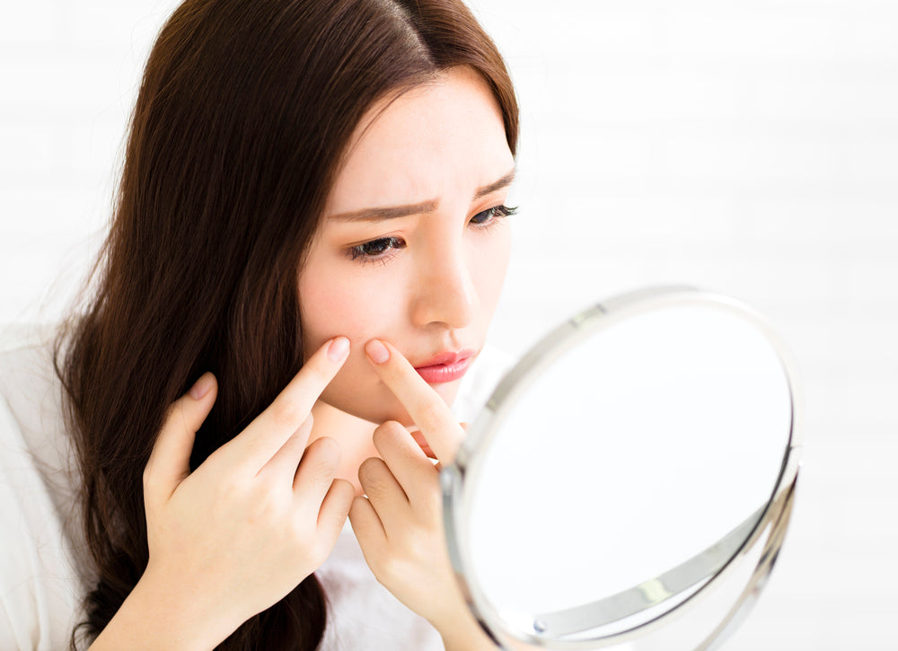 6 Questions You Wanted to Ask a Dermatologist about Adult Acne