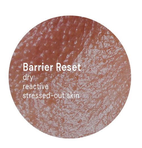 Barrier Reset System