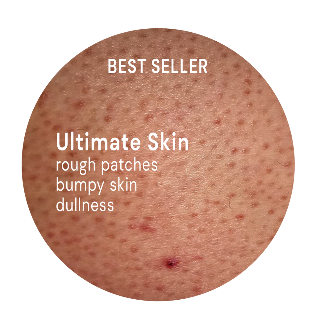 Ultimate Skin System