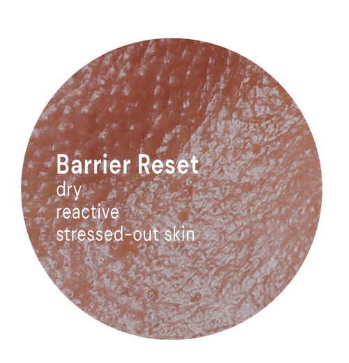 Barrier Reset System