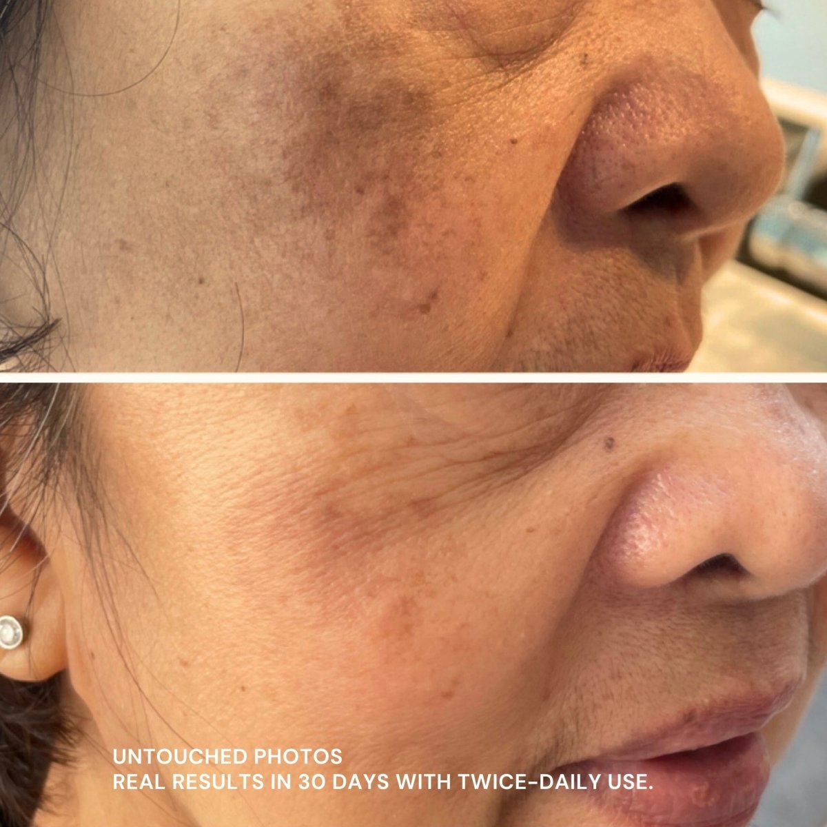 Discoloration Fade Wand