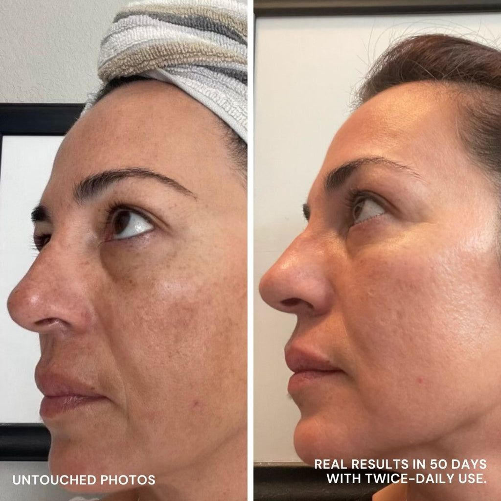 Discoloration Fade Wand