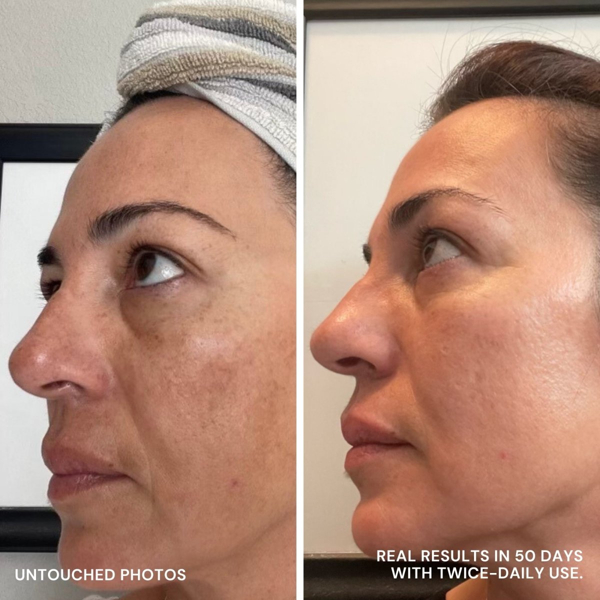 Discoloration Fade Wand