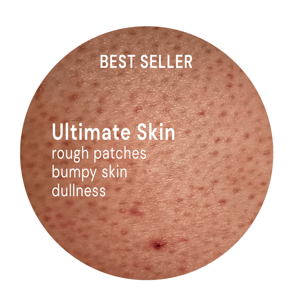 Ultimate Skin System