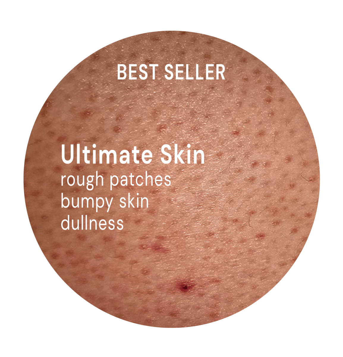 Ultimate Skin System